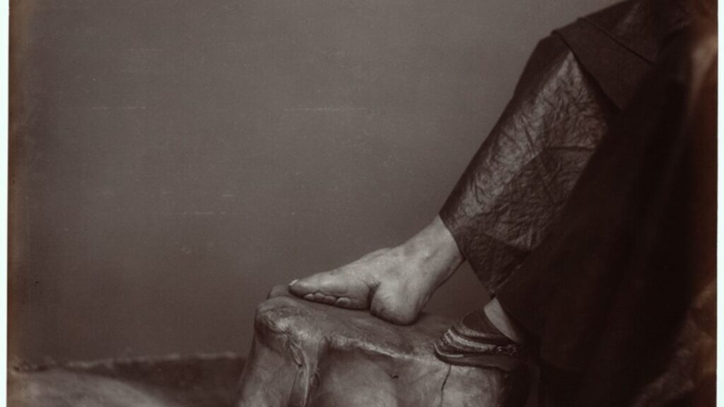 Foot Binding in China